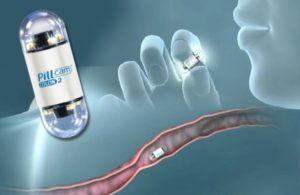 Ravenna: niente più colonscopia, arriva la videocapsula che filma l'intestino