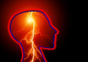 Epilessia