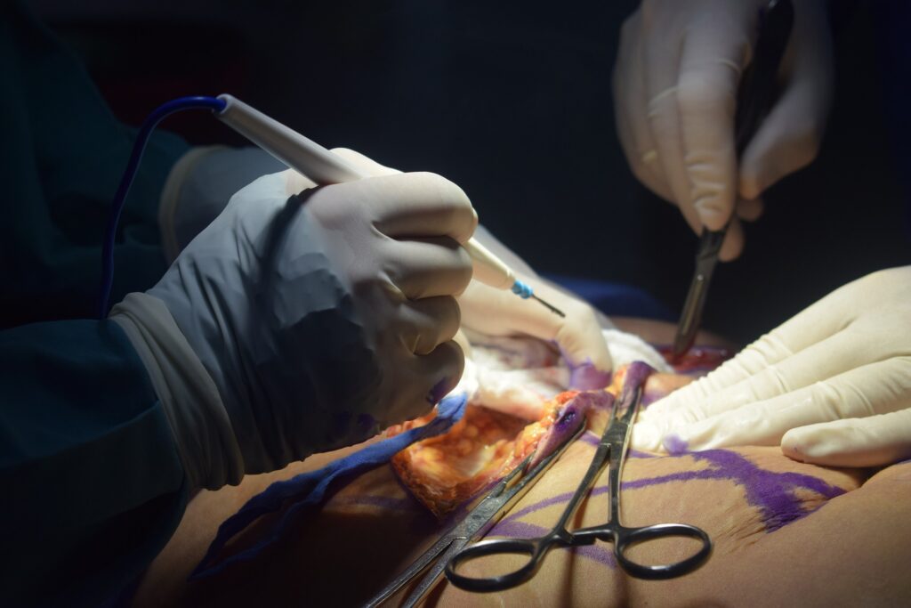 La realtà aumentata viene utilizzata per la prima volta per operare la spalla