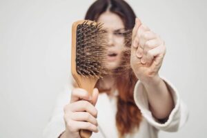 Caduta dei capelli donna