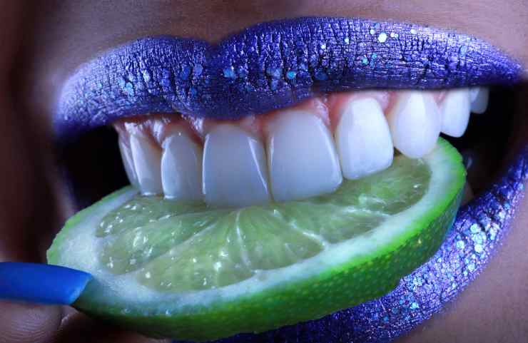 Denti bianchi