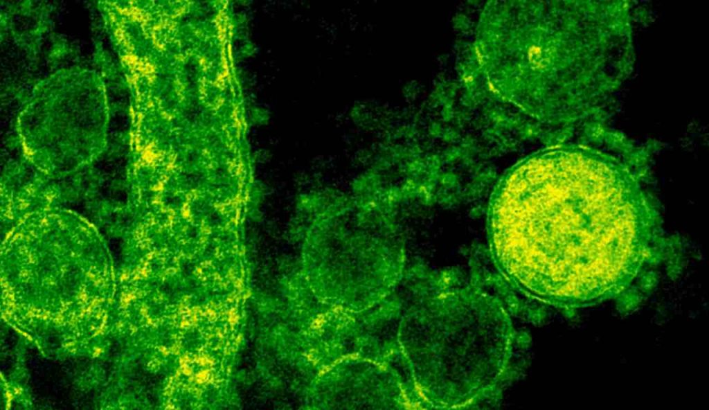 batteri al microscopio