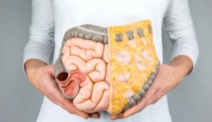 Intestino