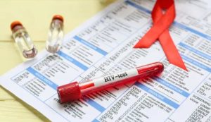 Test HIV