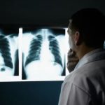 Valutazione cancro polmonare