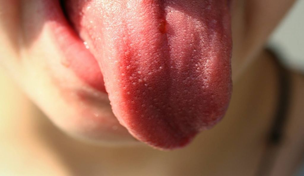 lingua rosa