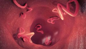 Parassiti nell'intestino (Depositphotos foto) - www.biomedicalcue.it